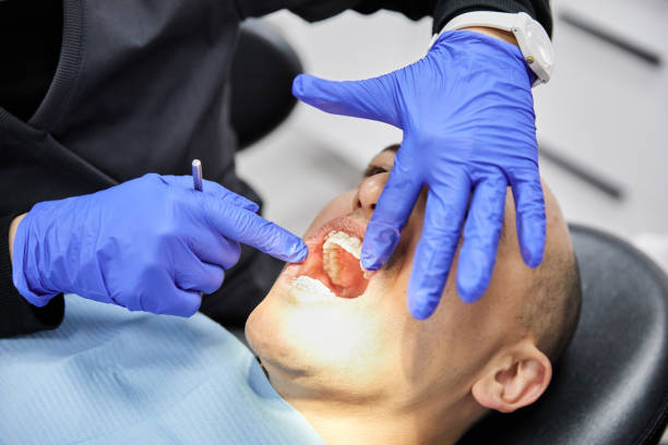 Best Emergency Wisdom Teeth Removal in Woodlawn Beach, FL