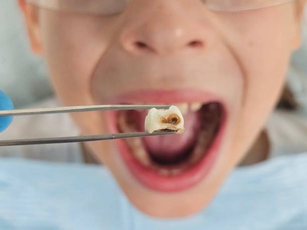 Best Emergency Dental Care for Trauma or Injury in Woodlawn Beach, FL